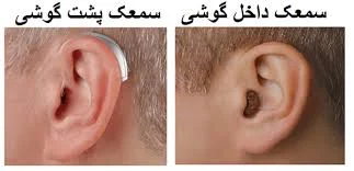 عوارض سمعک پشت گوشی چیست؟